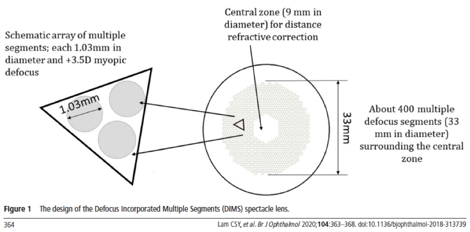 Myopia Control Spec lens design 1